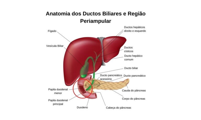 Colangiocarcinoma distal O que é e qual é o tratamento Dr Iron Pires