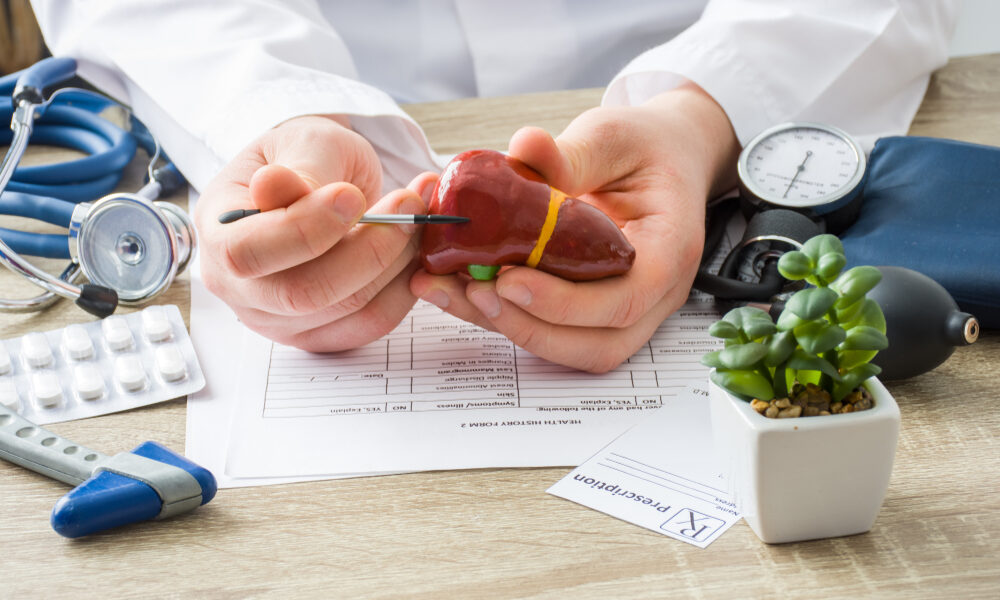 Médico com um figado de modelo anatomico, mostrando cirurgia de figado